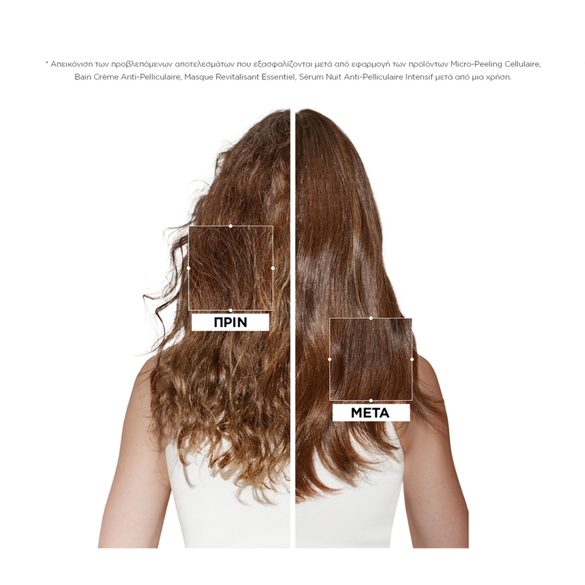 Kerastase Symbiose Symbiose Micro Peeling Cellulaire Αντιπιτυριδική Περιποίηση Μικροαπολέπι3474637135744 3 Kerastase Symbiose Symbiose Micro Peeling Cellulaire Αντιπιτυριδική Περιποίηση Μικροαπολέπι3474637135744 3